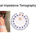 Electrical Impedance Tomography