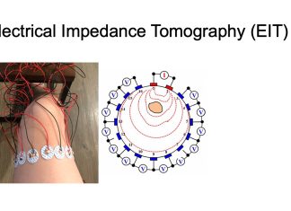 Electrical Impedance Tomography