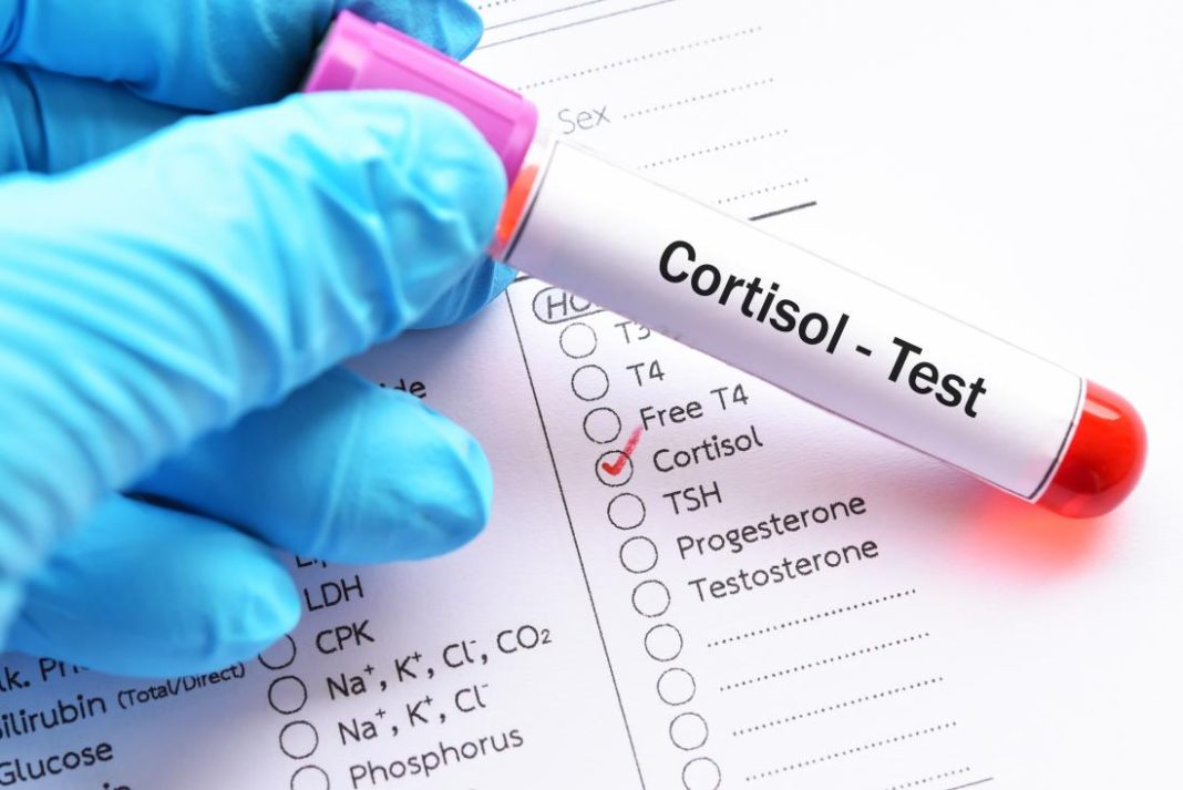 cortisol test kit