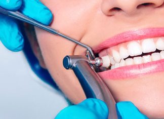 teeth cleaning and polishing